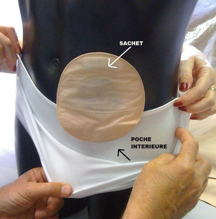Stoma Frauen-Slip Art.555 ORIONE®